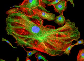 Fluorescence Fluorescence